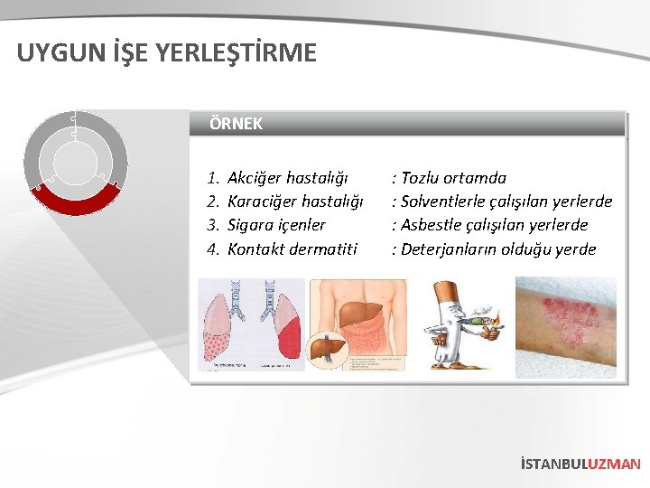 UYGUN İŞE YERLEŞTİRME ÖRNEK 1. 2. 3. 4. Akciğer hastalığı Karaciğer hastalığı Sigara içenler UYGUN İŞE YERLEŞTİRME ÖRNEK 1. 2. 3. 4. Akciğer hastalığı Karaciğer hastalığı Sigara içenler