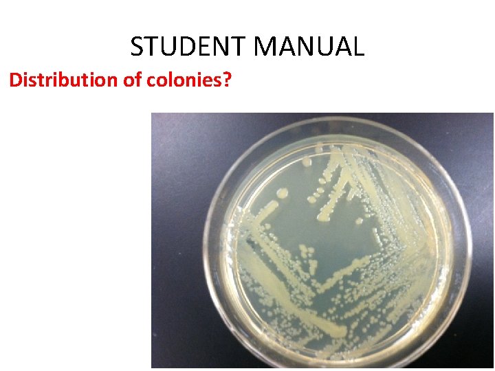 STUDENT MANUAL Distribution of colonies? 