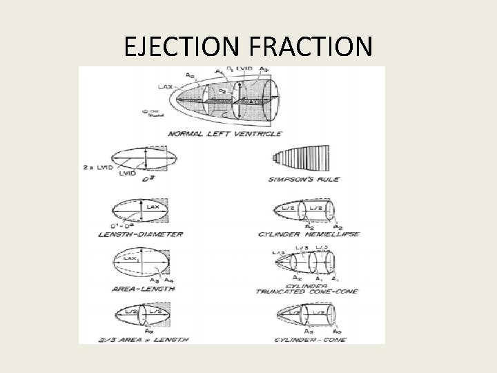 EJECTION FRACTION 