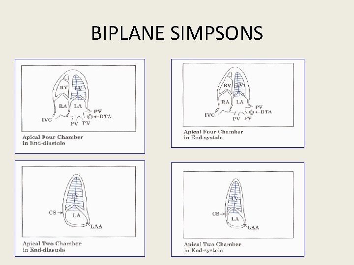 BIPLANE SIMPSONS 