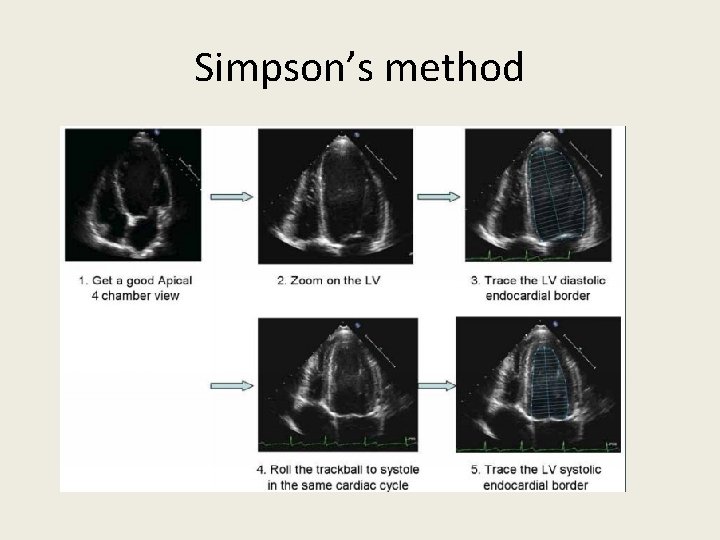 Simpson’s method 