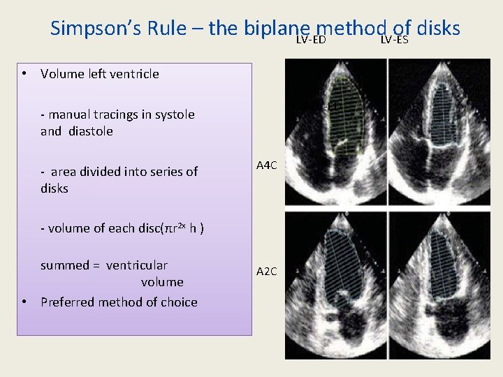 Simpson’s Rule – the biplane method of disks LV-ED LV-ES • Volume left ventricle