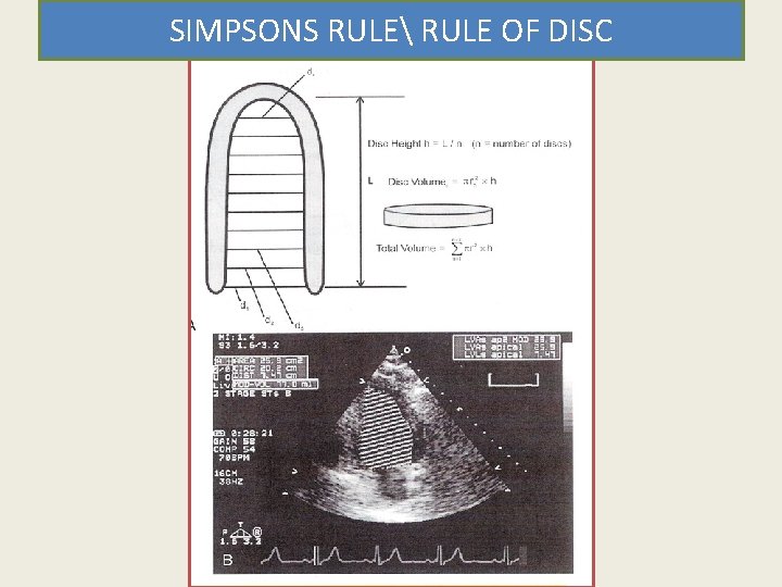 SIMPSONS RULE RULE OF DISC 