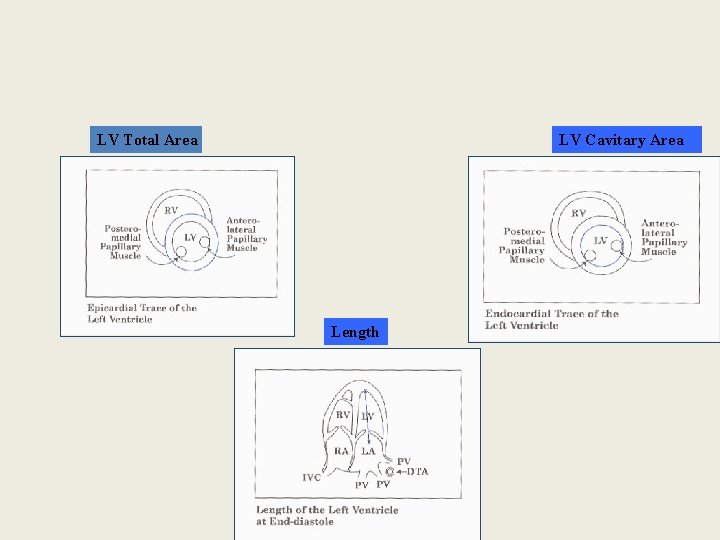 LV Total Area LV Cavitary Area Length 