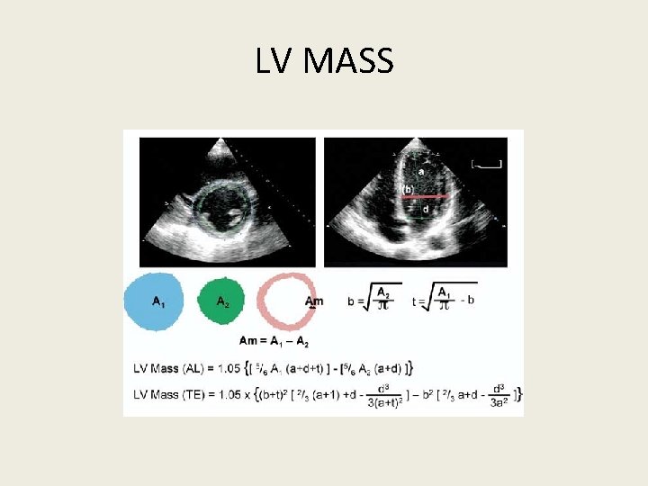 LV MASS 