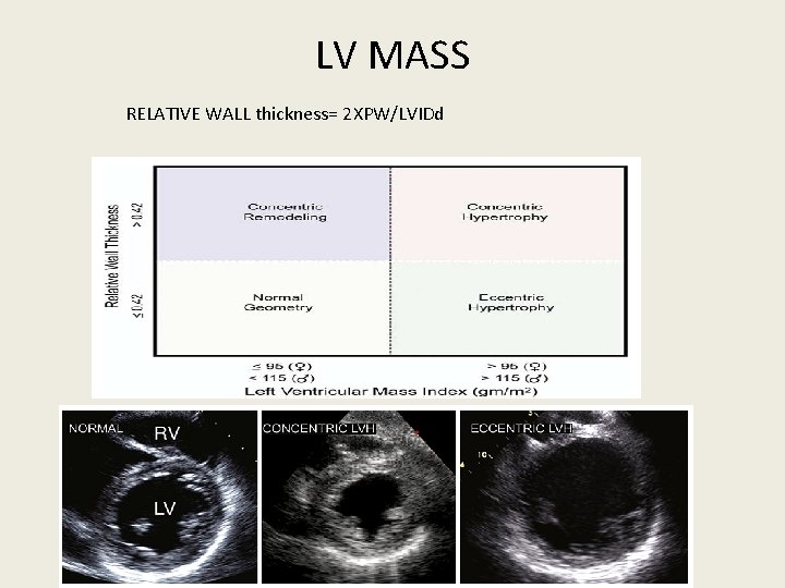 LV MASS RELATIVE WALL thickness= 2 XPW/LVIDd 