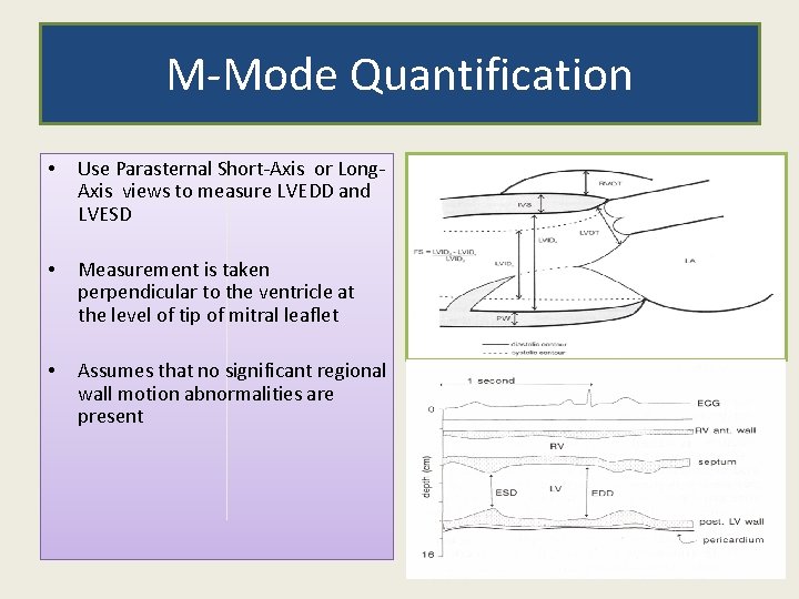 M-Mode Quantification • Use Parasternal Short-Axis or Long. Axis views to measure LVEDD and