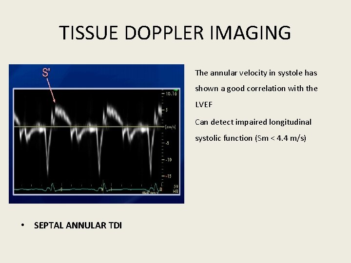 TISSUE DOPPLER IMAGING • The annular velocity in systole has shown a good correlation