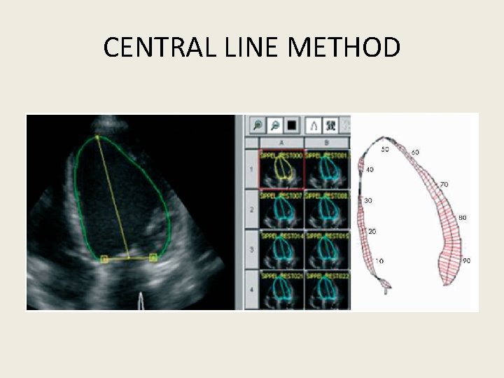 CENTRAL LINE METHOD 