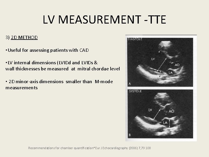 LV MEASUREMENT -TTE 3) 2 D METHOD • Useful for assessing patients with CAD
