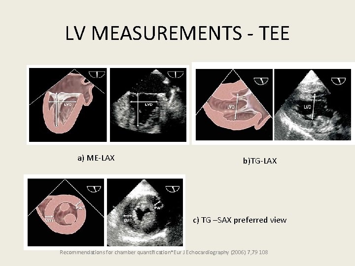 LV MEASUREMENTS - TEE a) ME-LAX b)TG-LAX c) TG –SAX preferred view Recommendations for