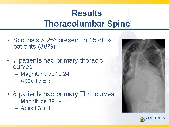 Results Thoracolumbar Spine • Scoliosis > 25° present in 15 of 39 patients (38%)