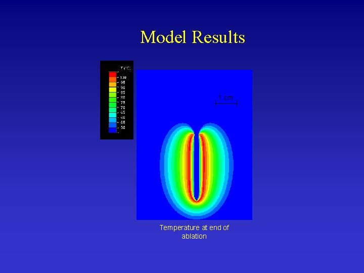 Model Results 1 cm Temperature at end of ablation 