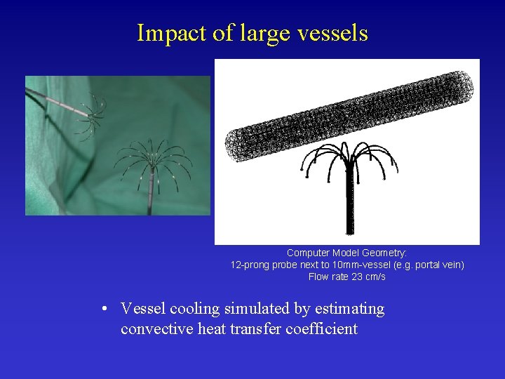 Impact of large vessels Computer Model Geometry: 12 -prong probe next to 10 mm-vessel