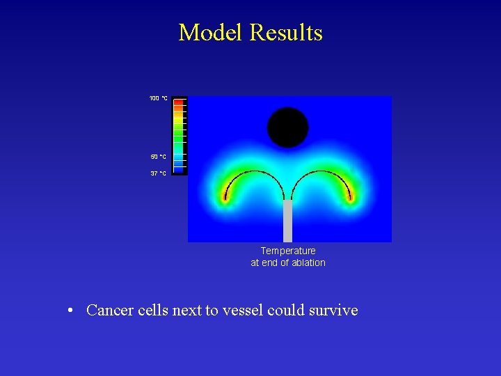 Model Results 100 °C 50 °C 37 °C Temperature at end of ablation •