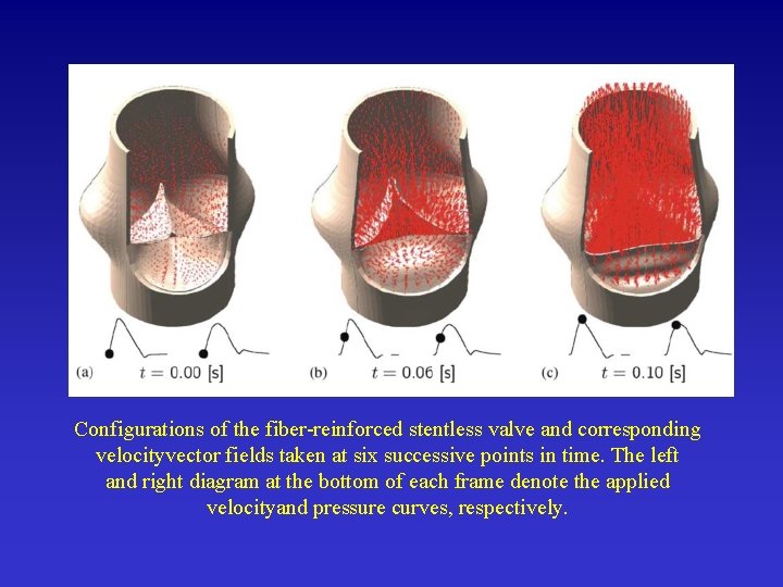 Configurations of the fiber-reinforced stentless valve and corresponding velocityvector fields taken at six successive