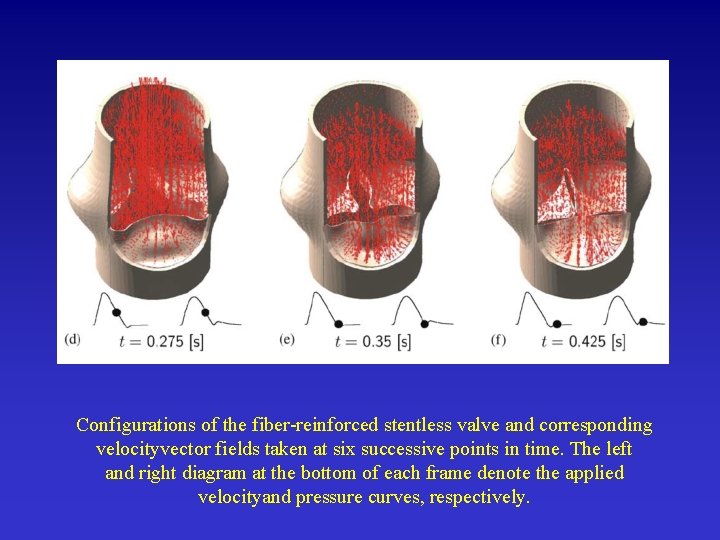 Configurations of the fiber-reinforced stentless valve and corresponding velocityvector fields taken at six successive