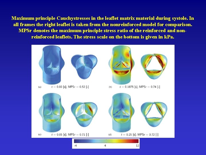 Maximum principle Cauchystresses in the leaflet matrix material during systole. In all frames the