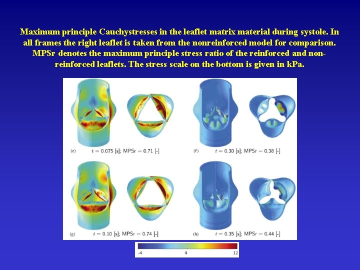 Maximum principle Cauchystresses in the leaflet matrix material during systole. In all frames the