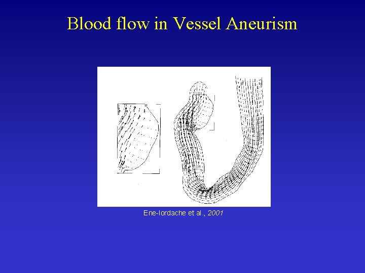 Blood flow in Vessel Aneurism Ene-Iordache et al. , 2001 