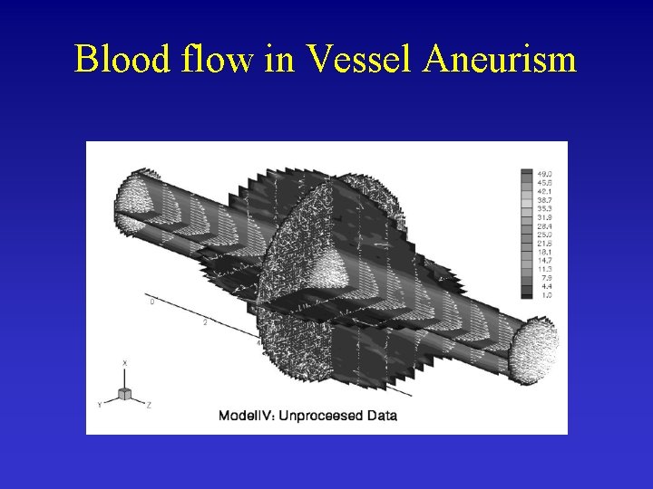 Blood flow in Vessel Aneurism 