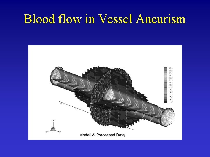 Blood flow in Vessel Aneurism 