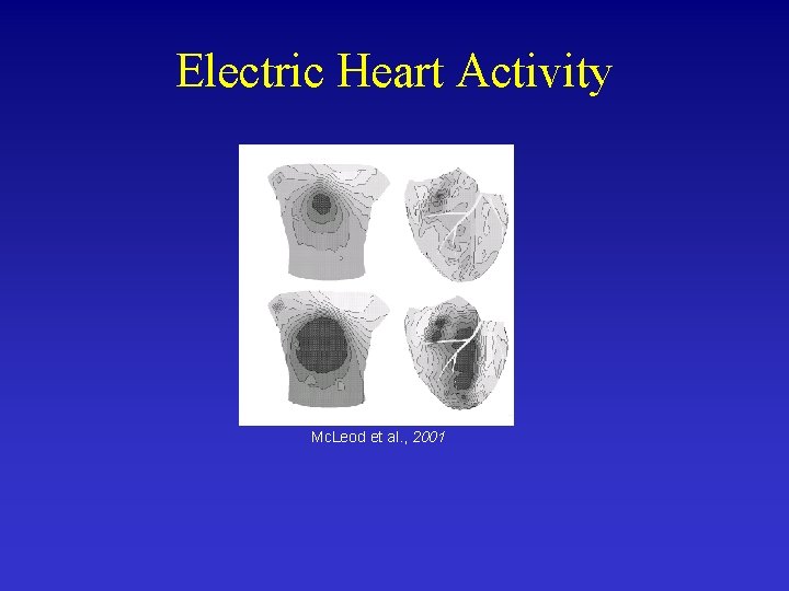 Electric Heart Activity Mc. Leod et al. , 2001 