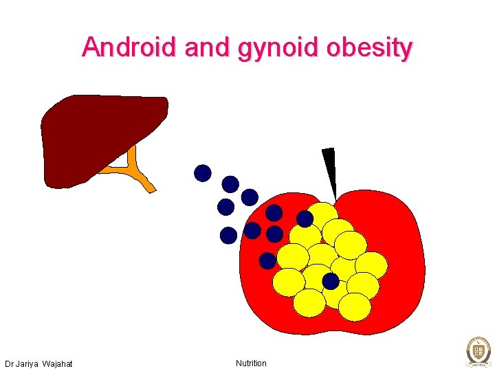 Android and gynoid obesity Dr Jariya Wajahat Nutrition 