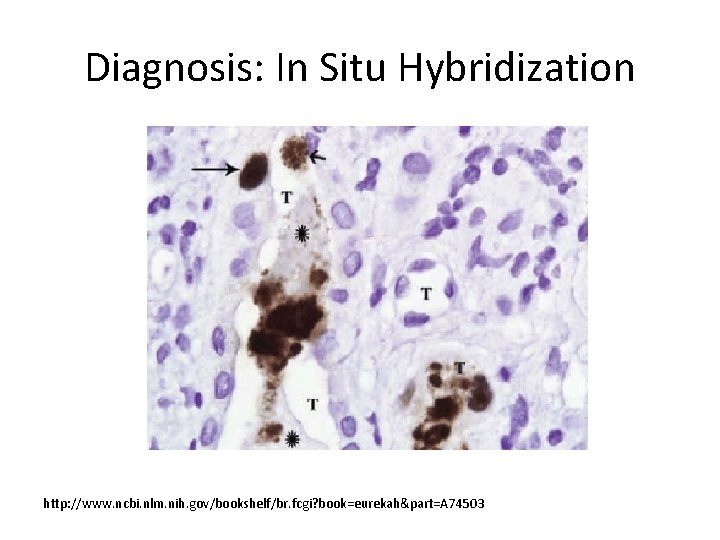 Diagnosis: In Situ Hybridization http: //www. ncbi. nlm. nih. gov/bookshelf/br. fcgi? book=eurekah&part=A 74503 