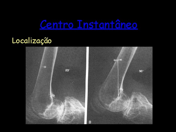 Centro Instantâneo Localização 