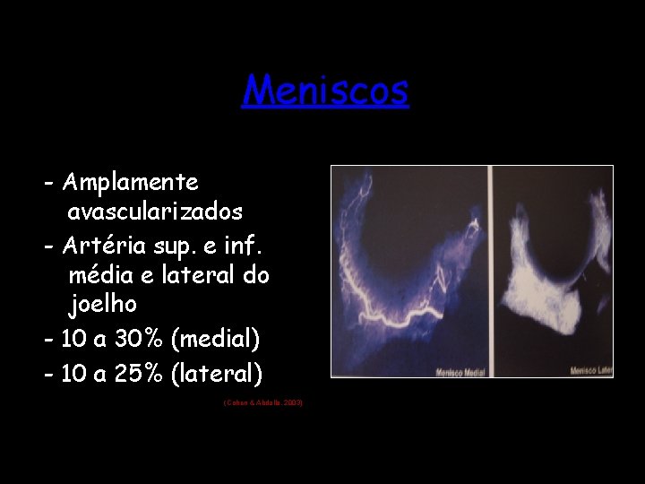 Meniscos - Amplamente avascularizados - Artéria sup. e inf. média e lateral do joelho