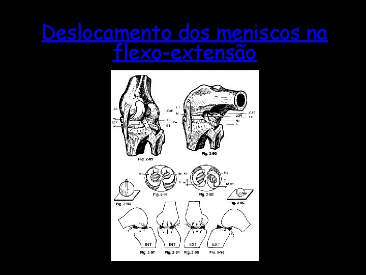 Deslocamento dos meniscos na flexo-extensão 