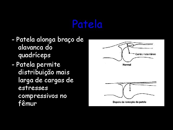 Patela - Patela alonga braço de alavanca do quadríceps - Patela permite distribuição mais