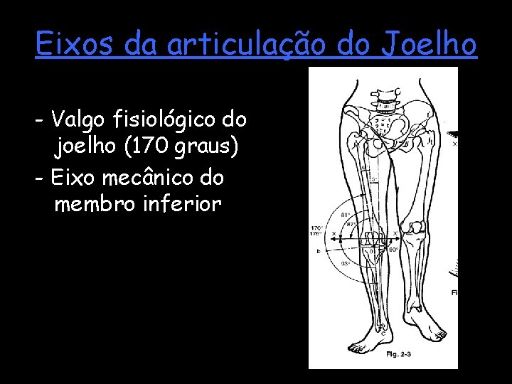 Eixos da articulação do Joelho - Valgo fisiológico do joelho (170 graus) - Eixo