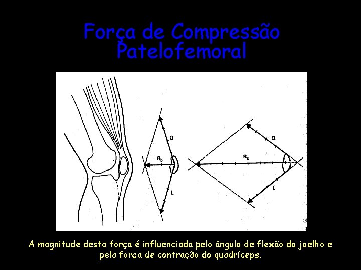 Força de Compressão Patelofemoral A magnitude desta força é influenciada pelo ângulo de flexão