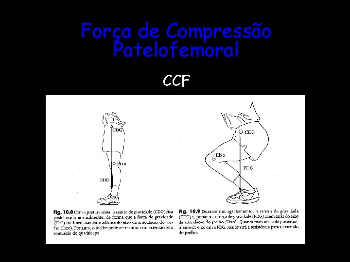 Força de Compressão Patelofemoral CCF 