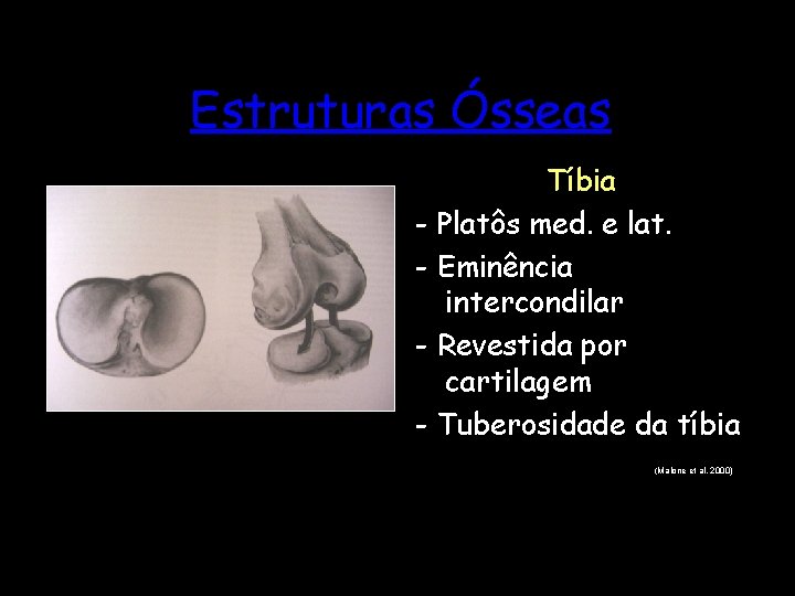 Estruturas Ósseas Tíbia - Platôs med. e lat. - Eminência intercondilar - Revestida por