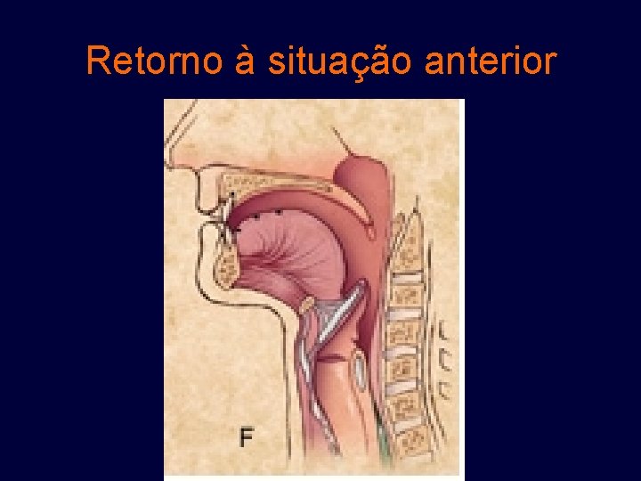 Retorno à situação anterior 