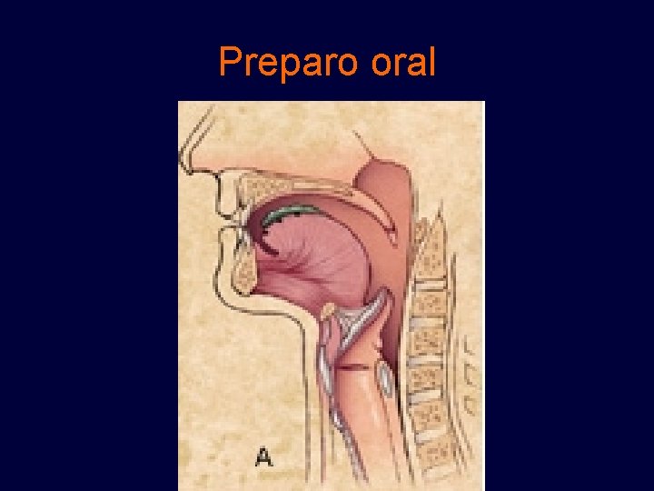 Preparo oral 