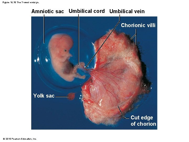 Figure 16. 18 The 7 -week embryo. Amniotic sac Umbilical cord Umbilical vein Chorionic