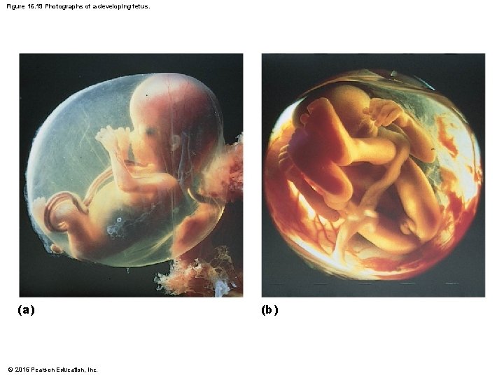 Figure 16. 19 Photographs of a developing fetus. (a) © 2015 Pearson Education, Inc.