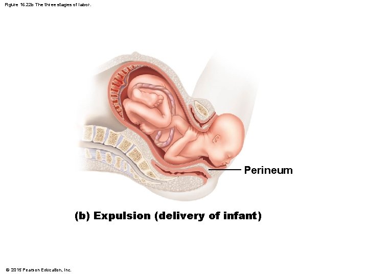 Figure 16. 22 b The three stages of labor. Perineum (b) Expulsion (delivery of