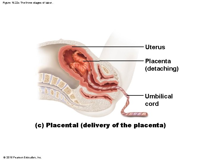 Figure 16. 22 c The three stages of labor. Uterus Placenta (detaching) Umbilical cord