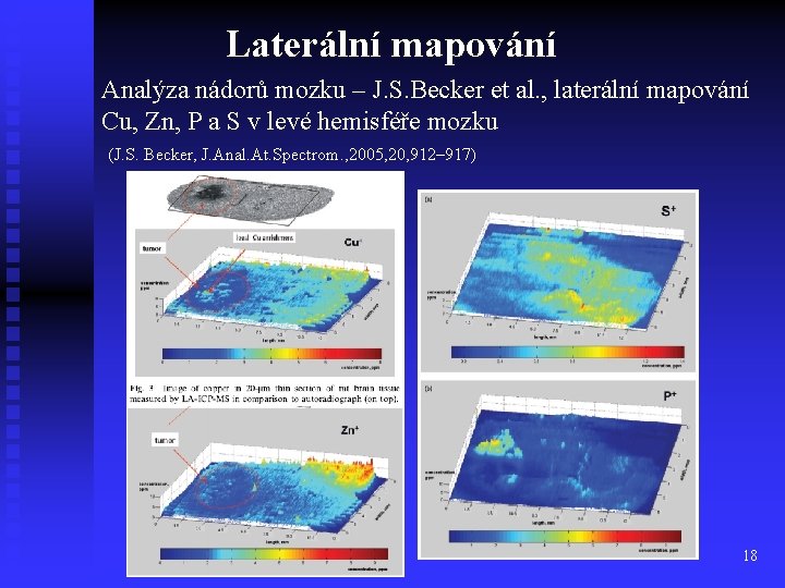 Laterální mapování Analýza nádorů mozku – J. S. Becker et al. , laterální mapování