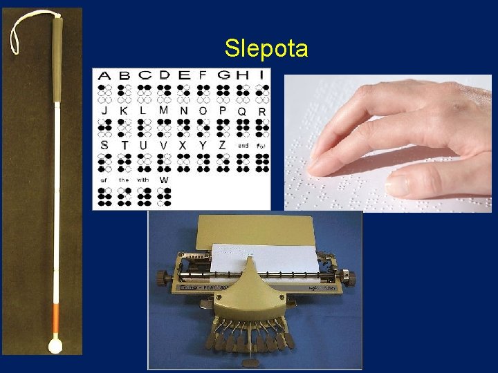  Slepota 