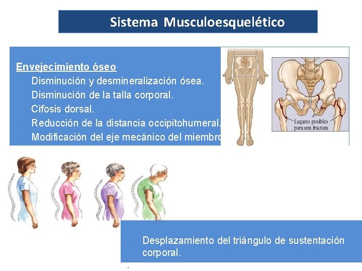 Sistema Musculoesquelético Envejecimiento óseo Disminución y desmineralización ósea. Disminución de la talla corporal. Cifosis