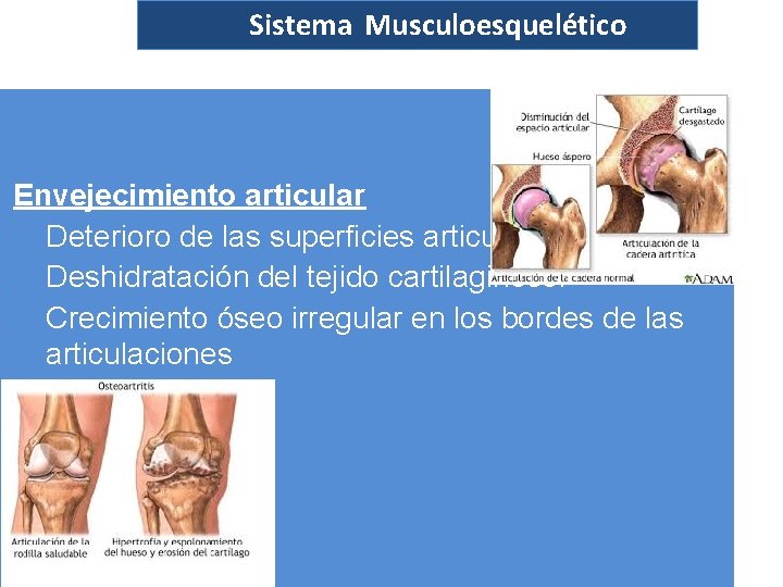 Sistema Musculoesquelético Envejecimiento articular Deterioro de las superficies articulares. Deshidratación del tejido cartilaginoso. Crecimiento