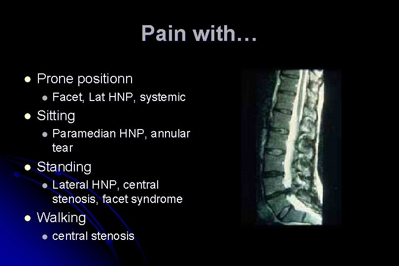 Pain with… l Prone positionn l l Sitting l l Paramedian HNP, annular tear