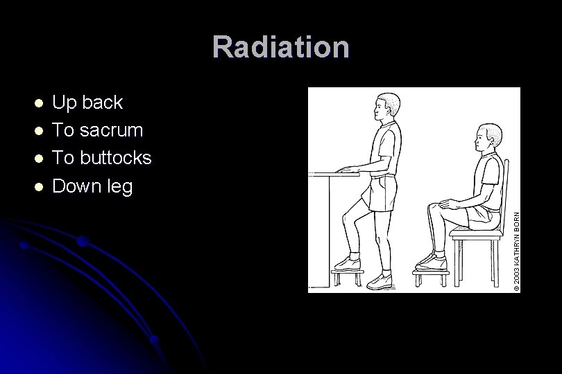 Radiation l l Up back To sacrum To buttocks Down leg 