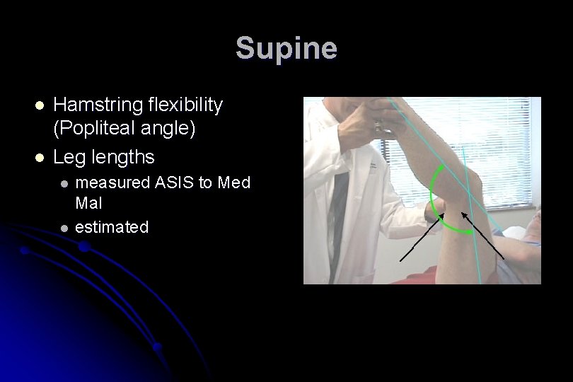 Supine l l Hamstring flexibility (Popliteal angle) Leg lengths l l measured ASIS to